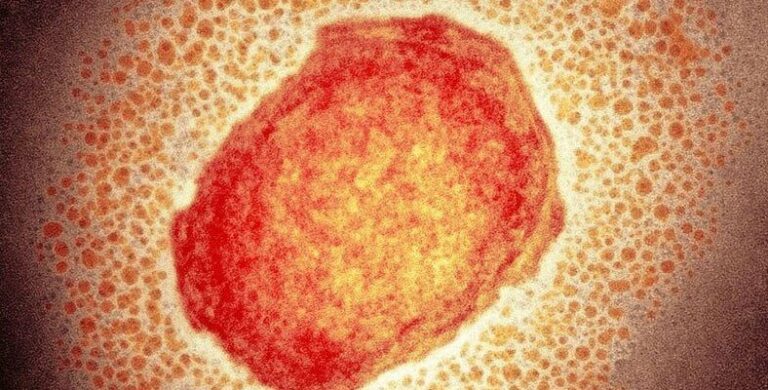 The-Number-of-Countries-With-Monkeypox-Virus-Raised-to-15-788x400
